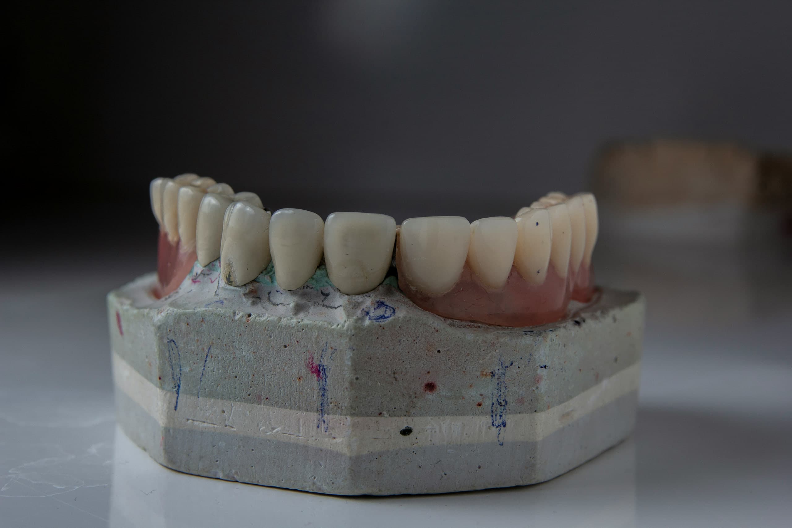 Model üzerinde prova — Model | Boyut Dental